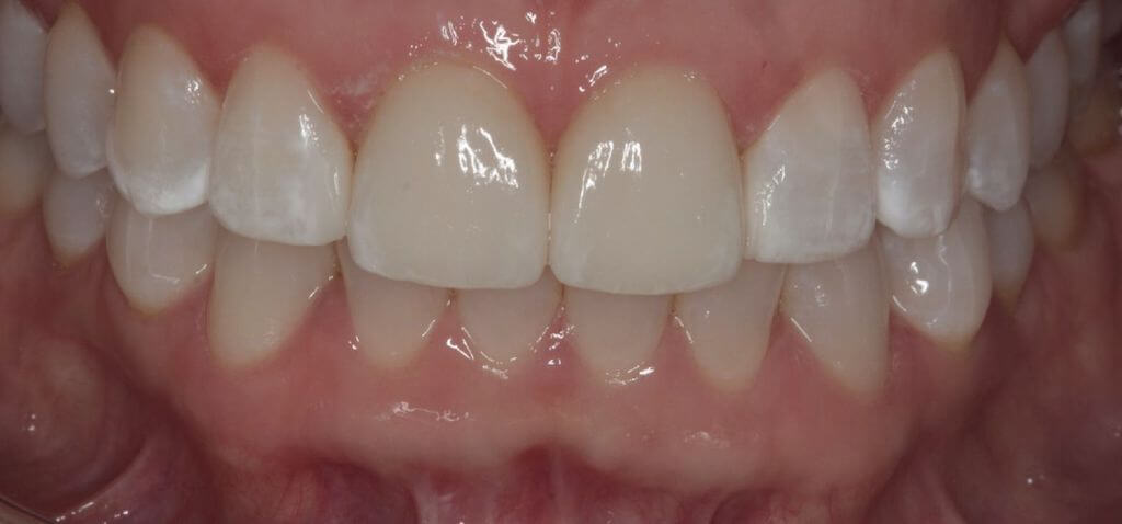 smile gallery image