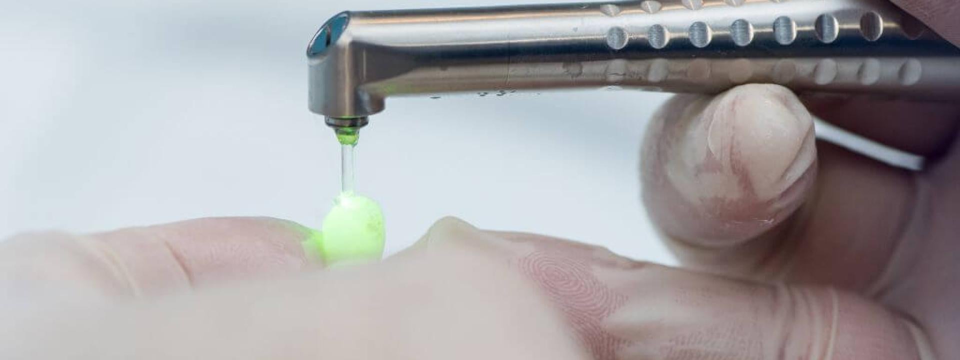 Dental laser drilling tooth for filling.
